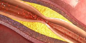 Kas yra aterosklerozė ir kaip to išvengti