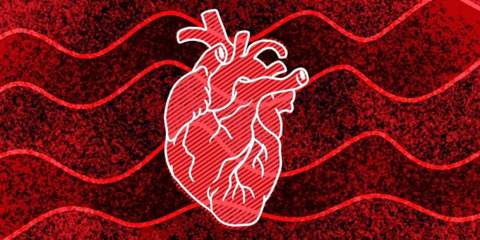 11 požymių, kad jums gali nutikti širdies sustojimas