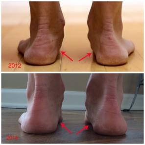 Kaip paleisti minimalistinio batus pakeisti pėdų