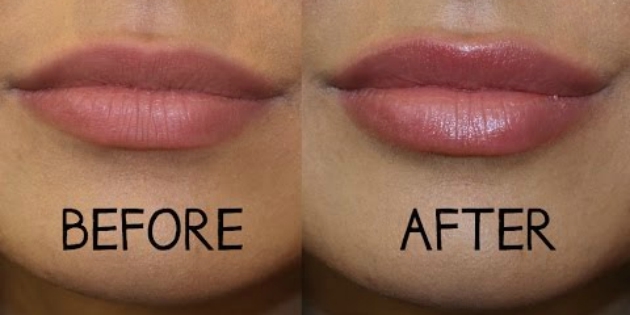 sutaupyti kosmetika: lūpų padidėjimas