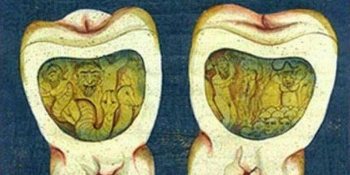Viduramžių medicina: puslapis iš Osmanų dantų trakto, XVII a.
