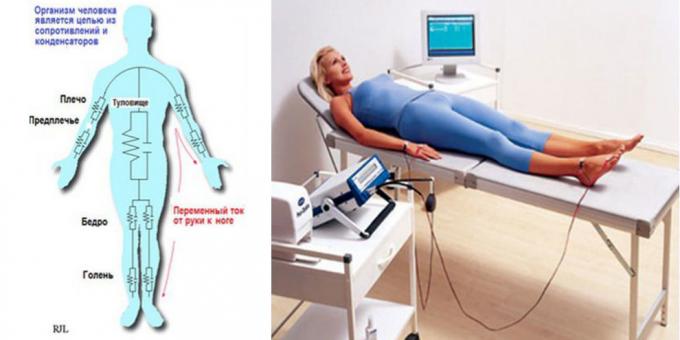 Kūno bioimpedance analizė prietaisas "MEDASS"